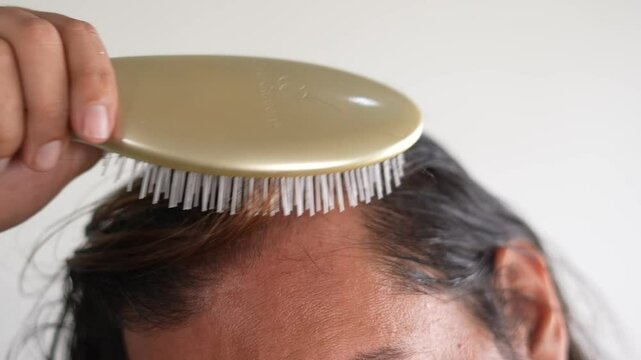 man using brush on his head with baldness, Brushing