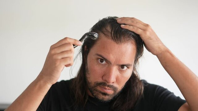 man wearing roller hair on his head to prevent baldness,Minoxidil