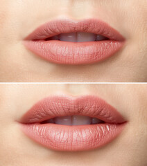 Fototapeta premium Collage of 2 photographs of women's lips before and after a cosmetic procedure. Beauty and cosmetic services concept. Design for beauty magazine, poster or banner.