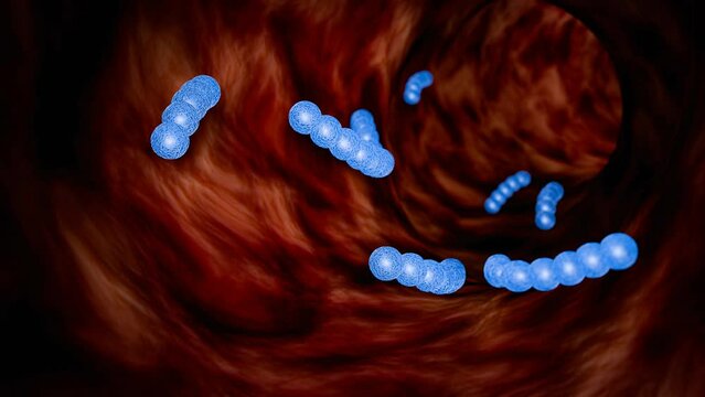Streptococcus type A, flesh-eating bacteria. The spread of bacteria in the body.  rare but severe bacterial infection caused by group A Streptococcus bacteria. 3D Rendering