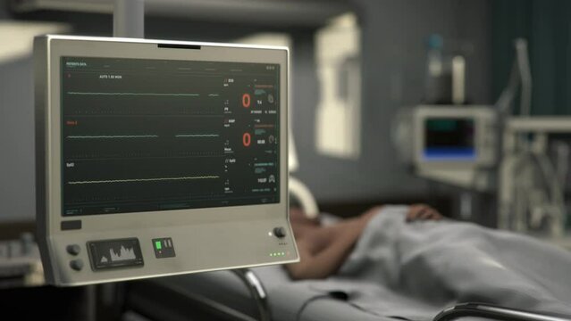 Modern Hospital Equipment Warns Patient Dying From Progressing Heart Disease. Patient In Emergency Condition Dying. Heart Rate Stop. Machine Monitoring Heartbeat Of Dying Patient. Clinic. ECG