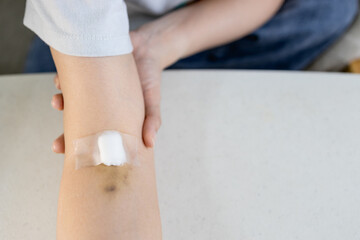Arm of woman with bruise on foldable joint from needle,plaster and cotton to cover wound,fragile vein,broken capillary blood vessels under skin,painful after blood test,medical checkup,blood donation