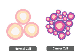 Normal Cell vs Cancer Cell, Loss of normal growth control of cell , healthy tissue and tumor, vector illustration.