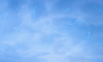 Eye floaters, muscae volitantes illuminates retinal shadows, vitreous humor changes. Spots floating...