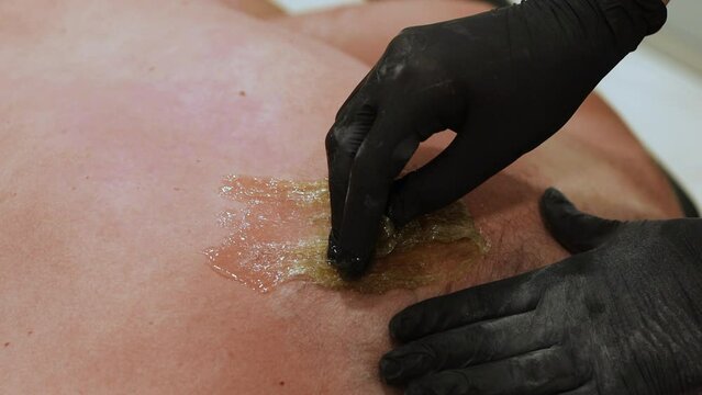 Beautician in black gloves epilating male back with Sugaring. Male beauty treatment, The process of waxing in a beauty salon