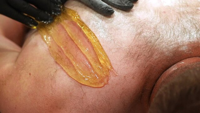 Beautician in black gloves epilating male back with Sugaring. Male beauty treatment, The process of waxing in a beauty salon