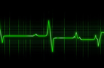 ekg heart beat
