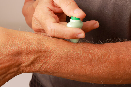 Man using a Pocket Zapper for mosquito bites and other bug bites to help stop the itching