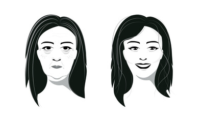 Before and after facial treatment concept. Aged face and young face vector illustration.