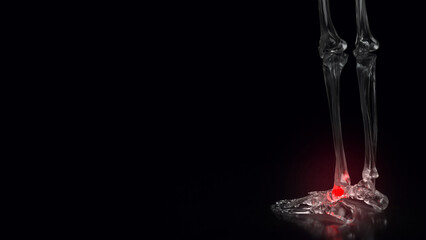 The Bone crystal for sprained ankle concept 3d rendering.