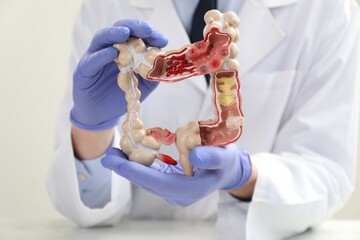 Doctor with model of large intestine, selective focus