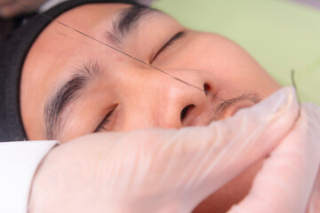 Using pre-inked threads to make guide lines around the eyebrows of a male patient to get te exact...