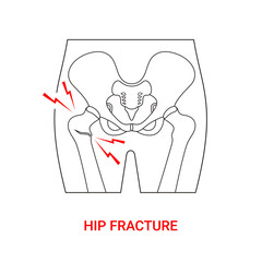 Hip fracture medical design with line style illustration