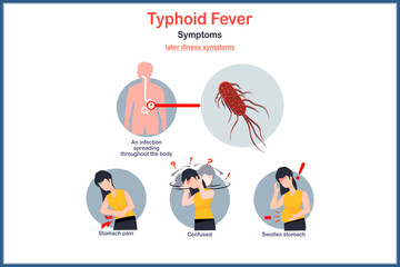 Medical illustration concept in flat style, later illness symptoms of typhoid fever.