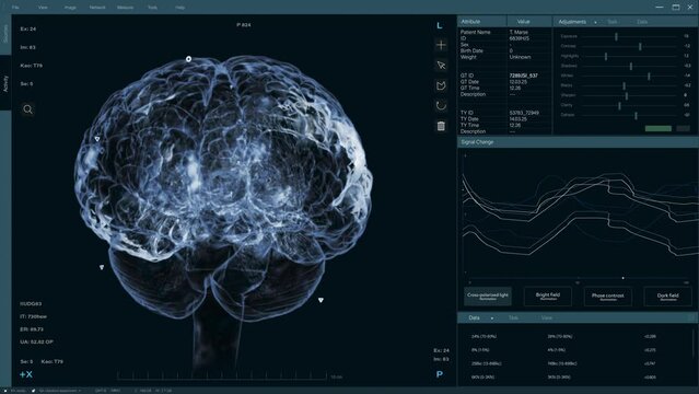 3D VFX Animation of a Brain Scan in Medical Software, Visualization of Neural Activity and Data. Medical Research for Brain Mapping and Enhancing and Neuroscience Tech Experiment Software
