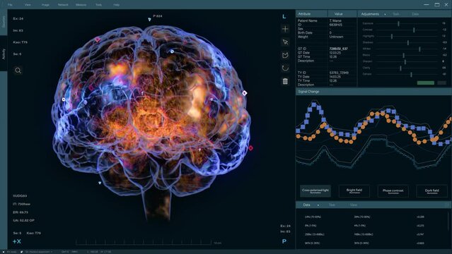3D VFX Animation of a Brain Scan in Medical Software, Visualization of Neural Activity and Data Visualization. Screen Replacement for Medical Hospitals and Software Engineers in Brain Research Science