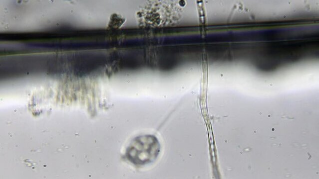 Microscopic life in a water droplet with bacteria, microorganisms, and plants. High magnification reveals paramecia and bacteria. Lab study of organic contamination in water.