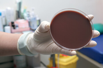 Scientist holding petri dish with agar in laboratory, showcasing microbiology and research in...