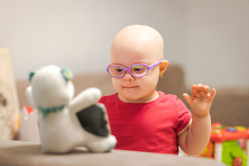 Girl with cancer and hair loss due to chemotherapy