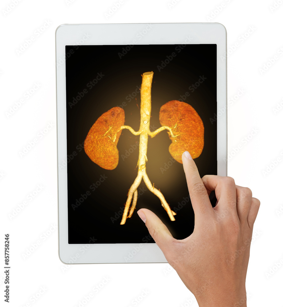 Poster the hand gestures towards a tablet displaying the detailed of cta renal artery 3d rendering image is