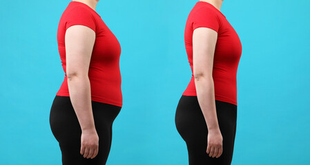 Collage with photos of woman before and after weight loss on light blue background, closeup