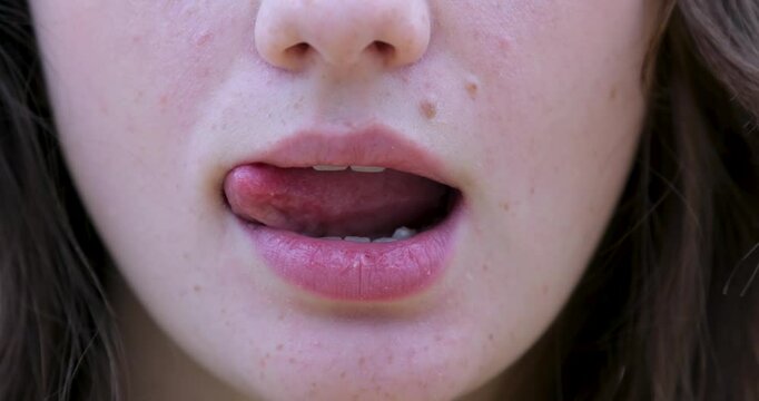 A young girl licks her lips with her tongue. Mole above lip, Close up