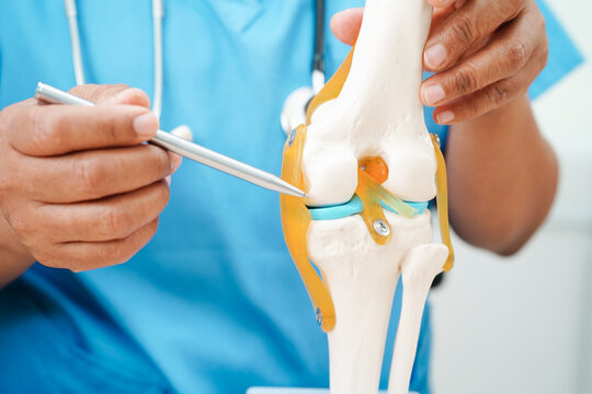 Knee osteoarthritis, Doctor showing model knee joint orthopedic.