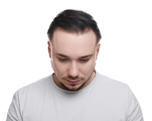 Obraz premium Baldness concept. Sad man with receding hairline on white background