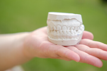 Orthopedic dentist doctor is holding teeth 3d printed gypsum model of the patient's jaw with...