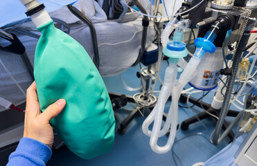 modern hospital anesthesia machine with airway ventilation system, featuring digital screens and...