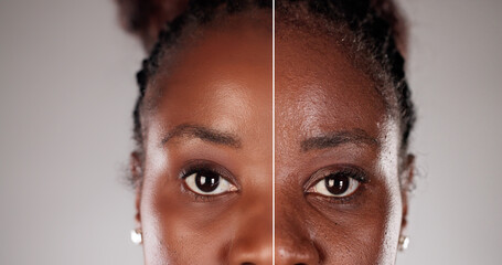 Youthful Transformation: A Brighter Future for Your Skin
