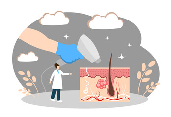 Laser hair removal. Hair removal from human skin. Beautician