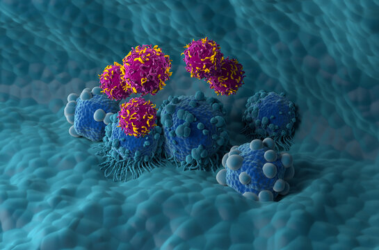 CAR T cell therapy in Pancreatic cancer - isometric view 3d illustration