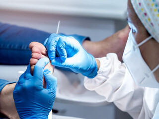 Female podiatrist doing chiropody in her podiatry clinic. Selective focus