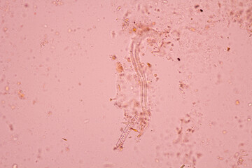 View in microscopic Strongyloides stercoralis or threadworm in human stool.Parasite infection.Medical background analyze by microscope, original magnification 400x
