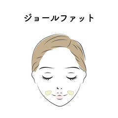 ジョールファット