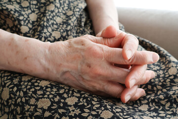 膝の上で手を組む高齢女性の手元