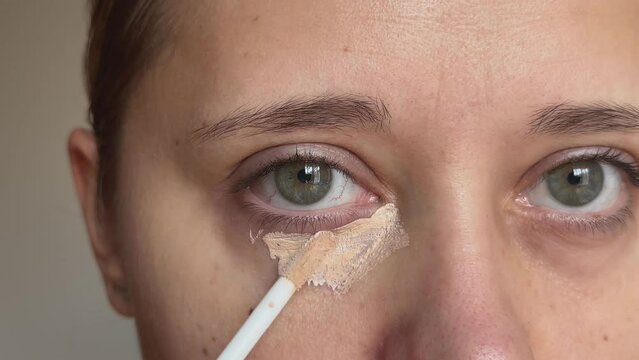 Close up of a young caucasian woman applying the concealer for dark eyes looking. Bruises, dark circles under the eyes. Foundation cream hiding spot imperfections on female face