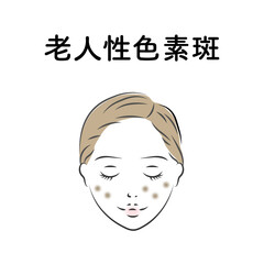 しみ_老人性色素斑