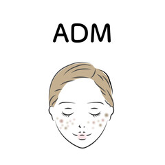 しみ_ADM