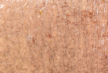 Hippopotamus skin as an abstract background. Texture