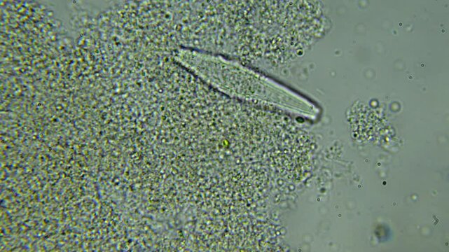 Bacteria, microorganisms, and plants in a water droplet under a microscope. High magnification reveals paramecia and bacteria. Lab research on organic contamination in water.