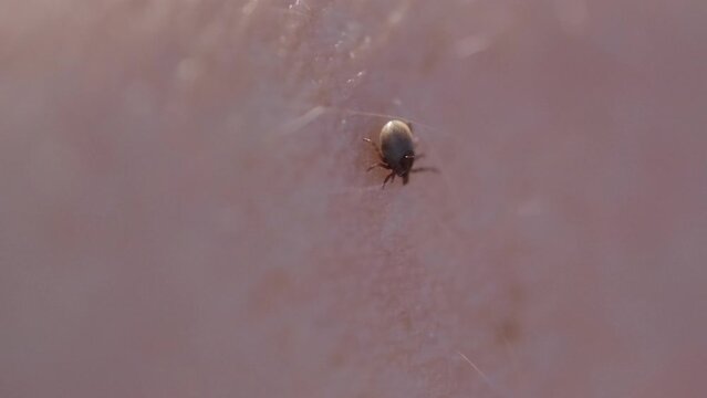 A tick on the skin that transmits dangerous diseases such as tick-borne encephalitis or Lyme disease.