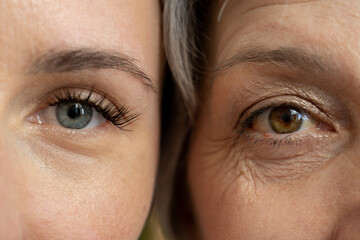 A close-up comparison of the eyes of a young woman and an older woman, highlighting the visible...