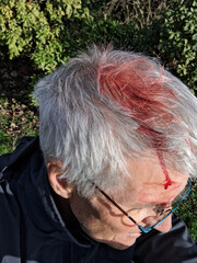 Blut am Kopf eines älteren Mannes - Symbolbild