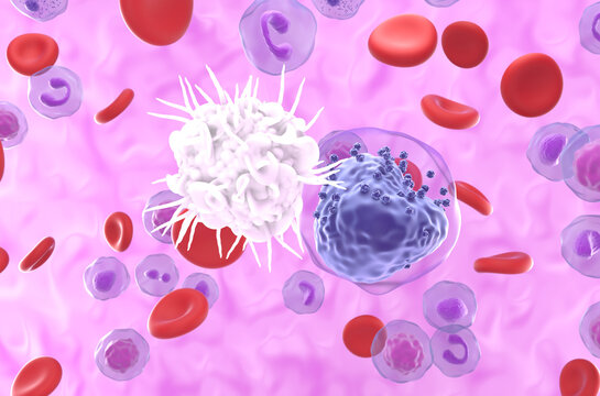Dendritic cell (DC) recognize Acute myeloid leukemia (AML) - closeup view 3d illustration