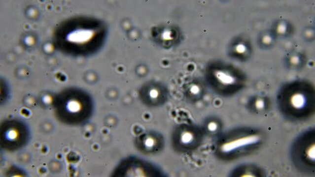 Observing life in a water droplet under a microscope. High magnification reveals bacteria, paramecia, and other microorganisms. Water tested for organic contamination in a laboratory.