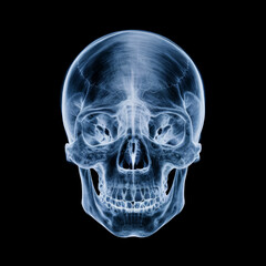 Obraz premium Detailed X-ray Image of Human Skull