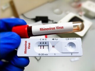 Fototapeta premium Blood sample and rapid test cassette for Rhino virus test.