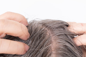 woman scratching brown hair, feeling itchy and possibly having lice, showing effects of...